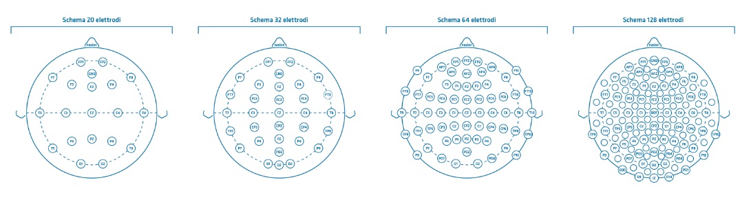 cách cắm điện cực điện não theo hệ thống chuẩn 10-20