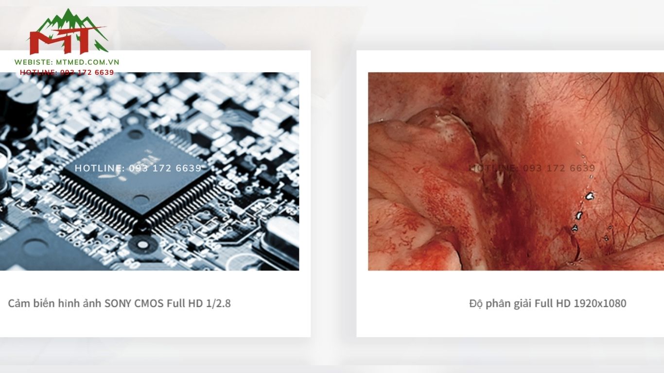 cảm biến và độ phân giải của hệ thống nội soi full hd ykd 9102
