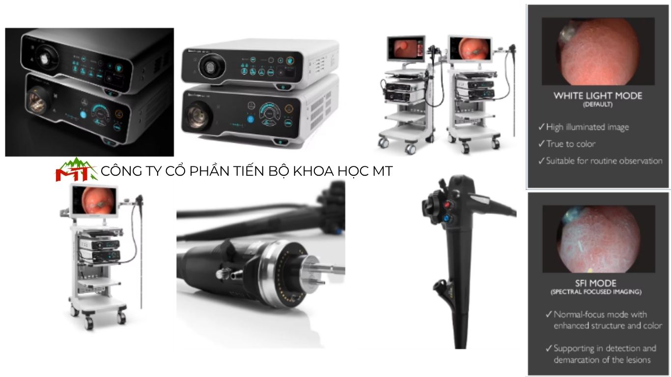 cấu tạo của hệ thống nội soi tiêu hóa
