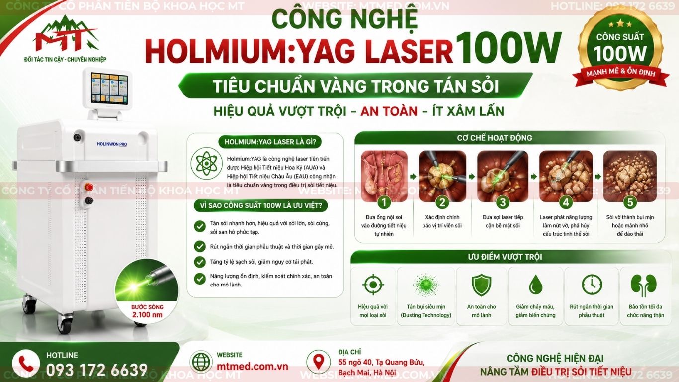 công nghệ holmium tiêu chuẩn vàng trong tán sỏi