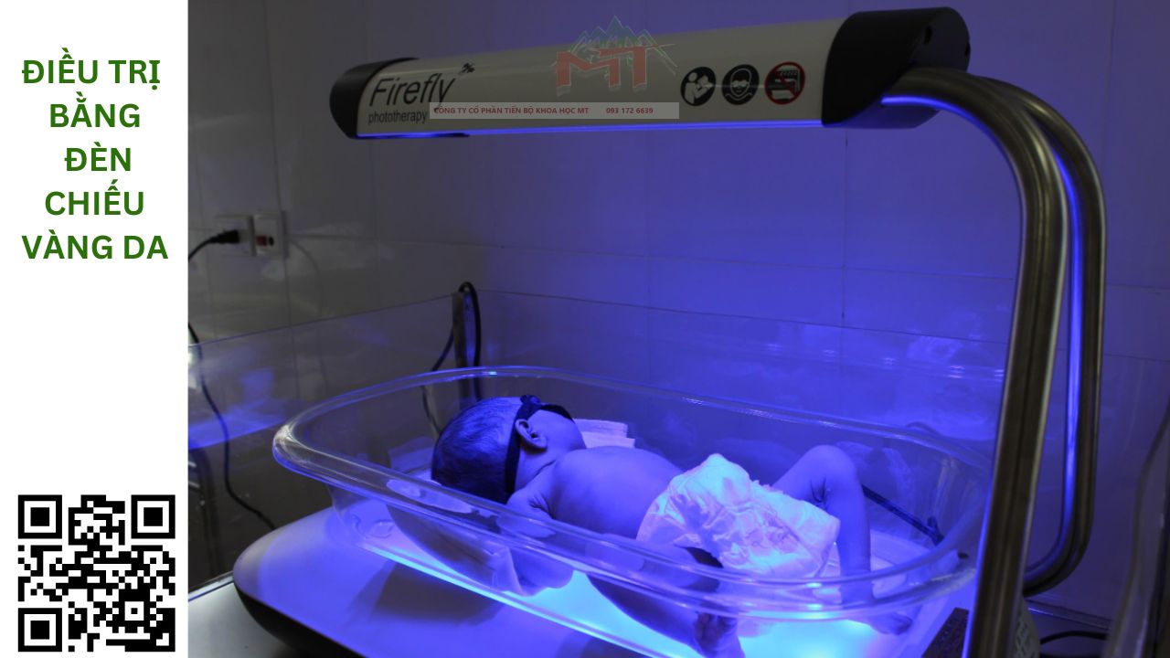 điều trị bằng đèn chiếu vàng da
