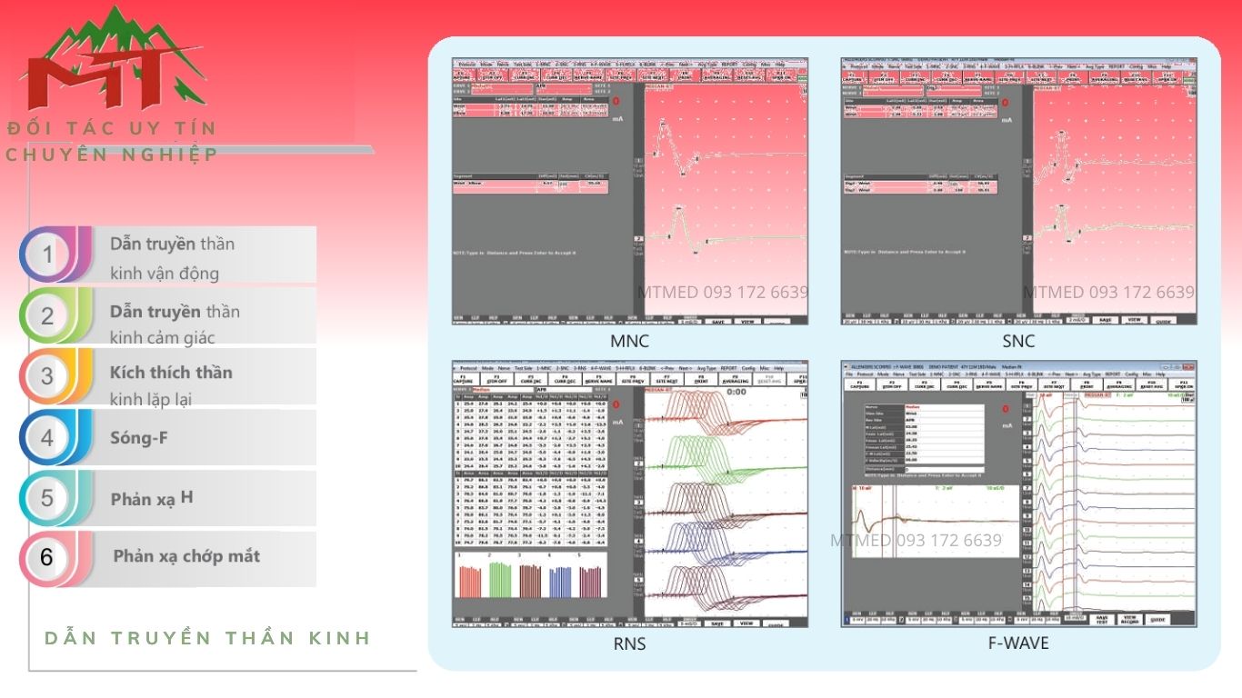 đo điện cơ đồ emg