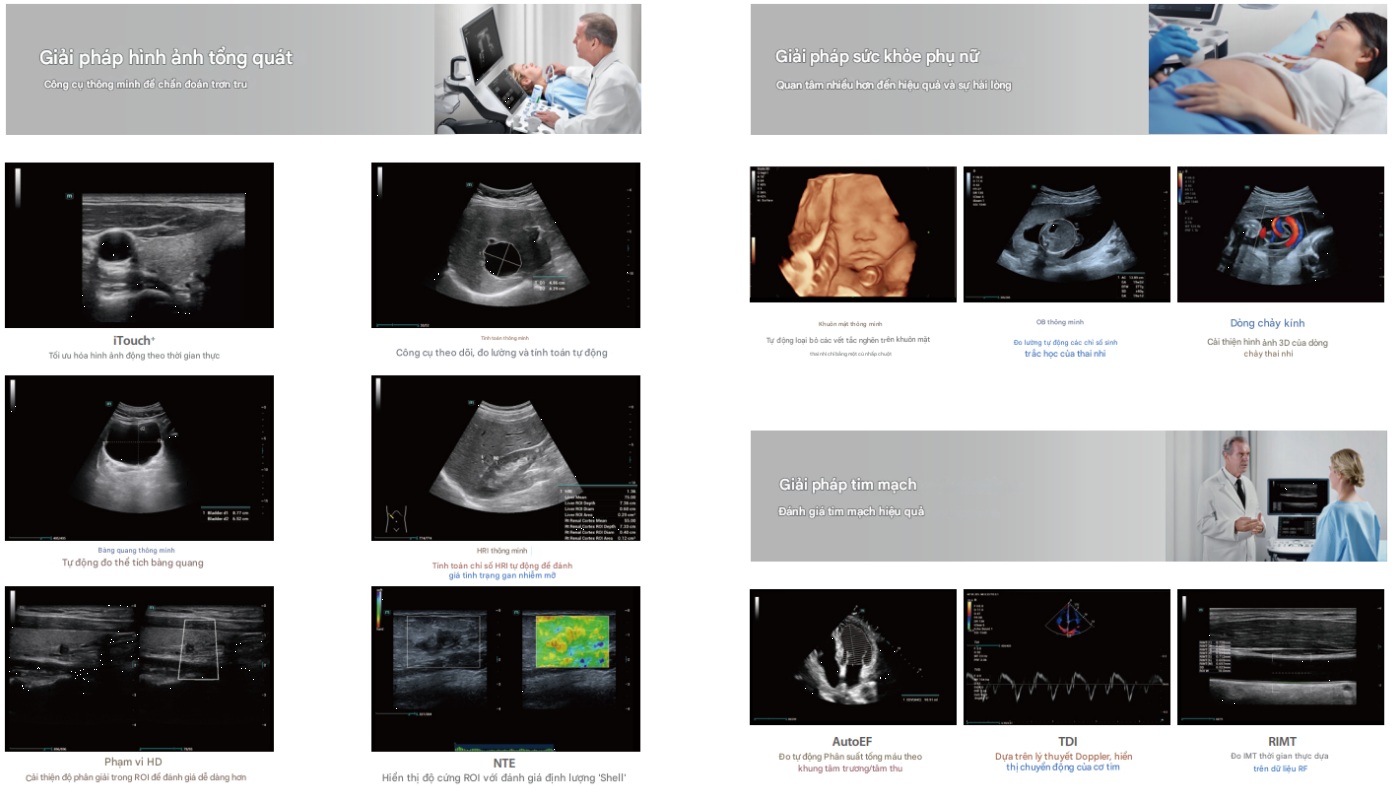 giải pháp hình ảnh của máy siêu âm màu n6 mindray
