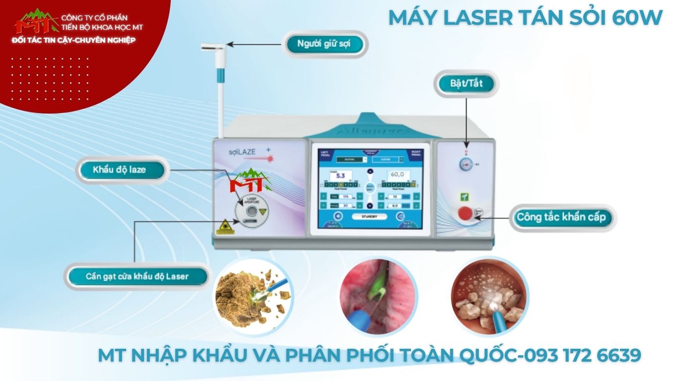 hệ thống laser tán sỏi công suất 60w