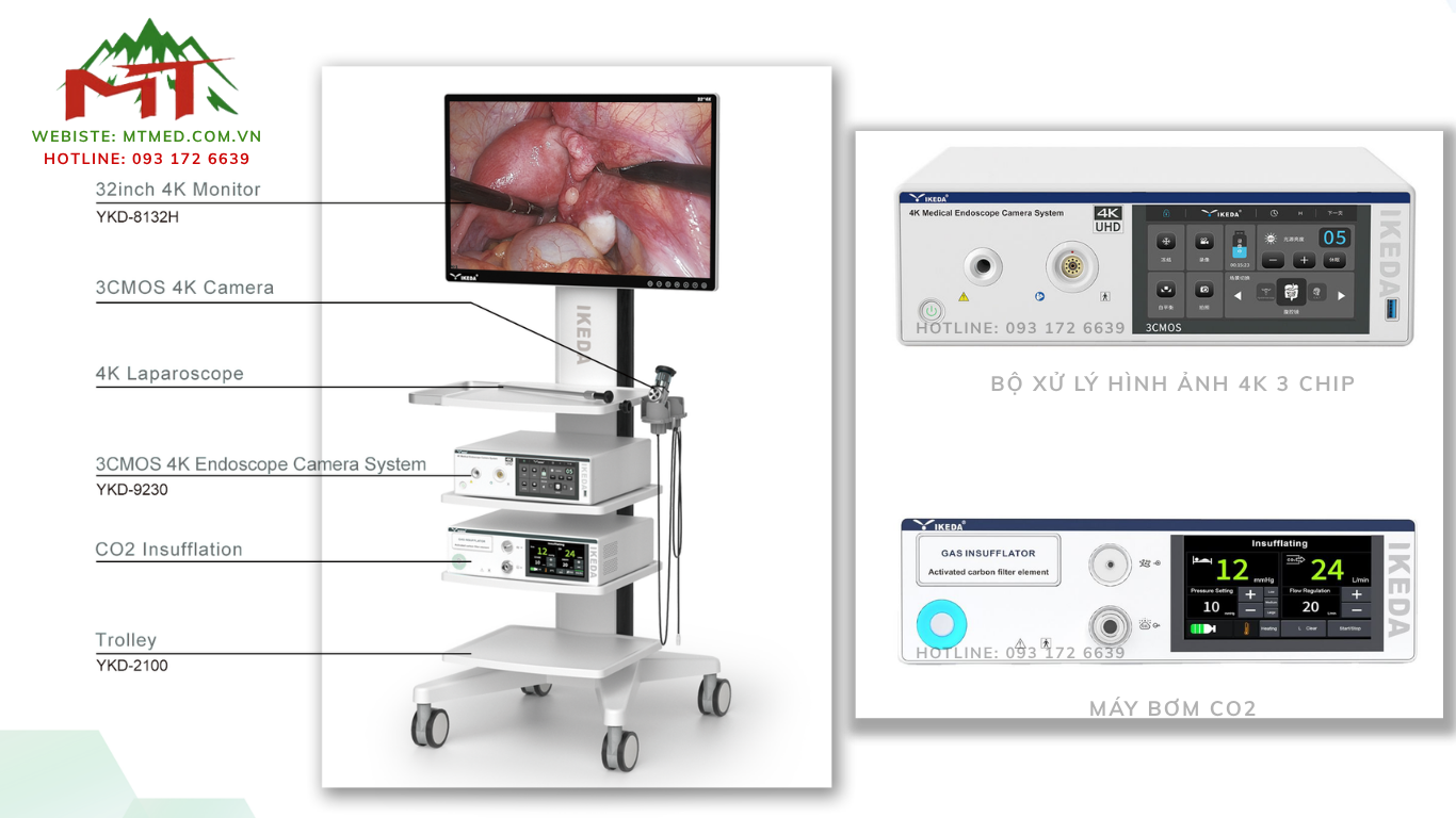 hệ thống phẫu thuật nội soi ổ bụng