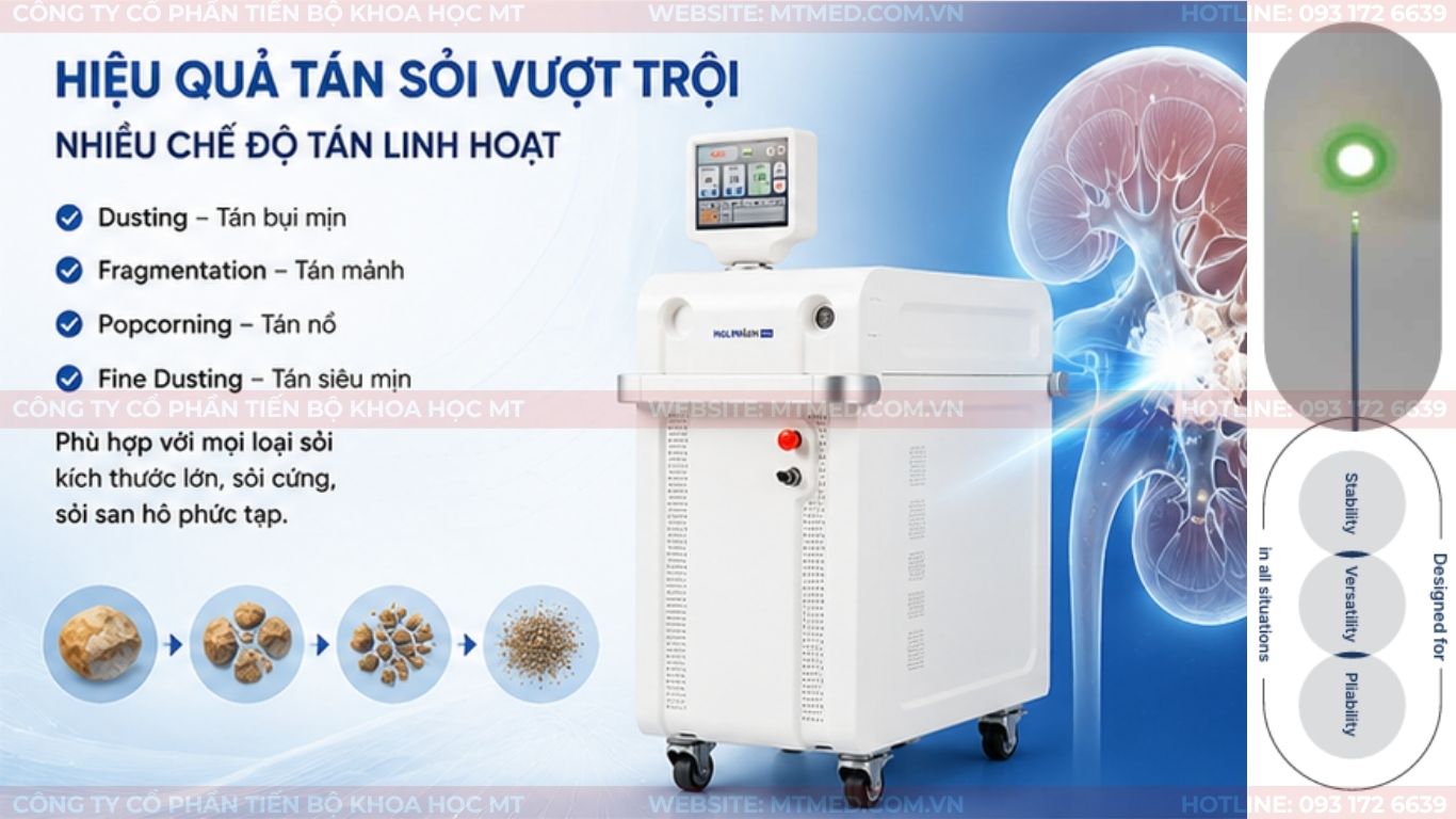 Hiệu quả của máy laser 100w trong tán sỏi