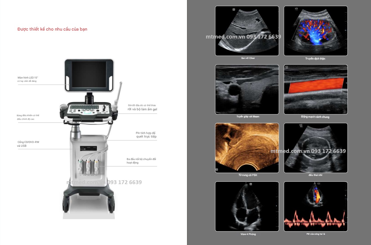 hình ảnh của máy siêu âm dc-30 midray