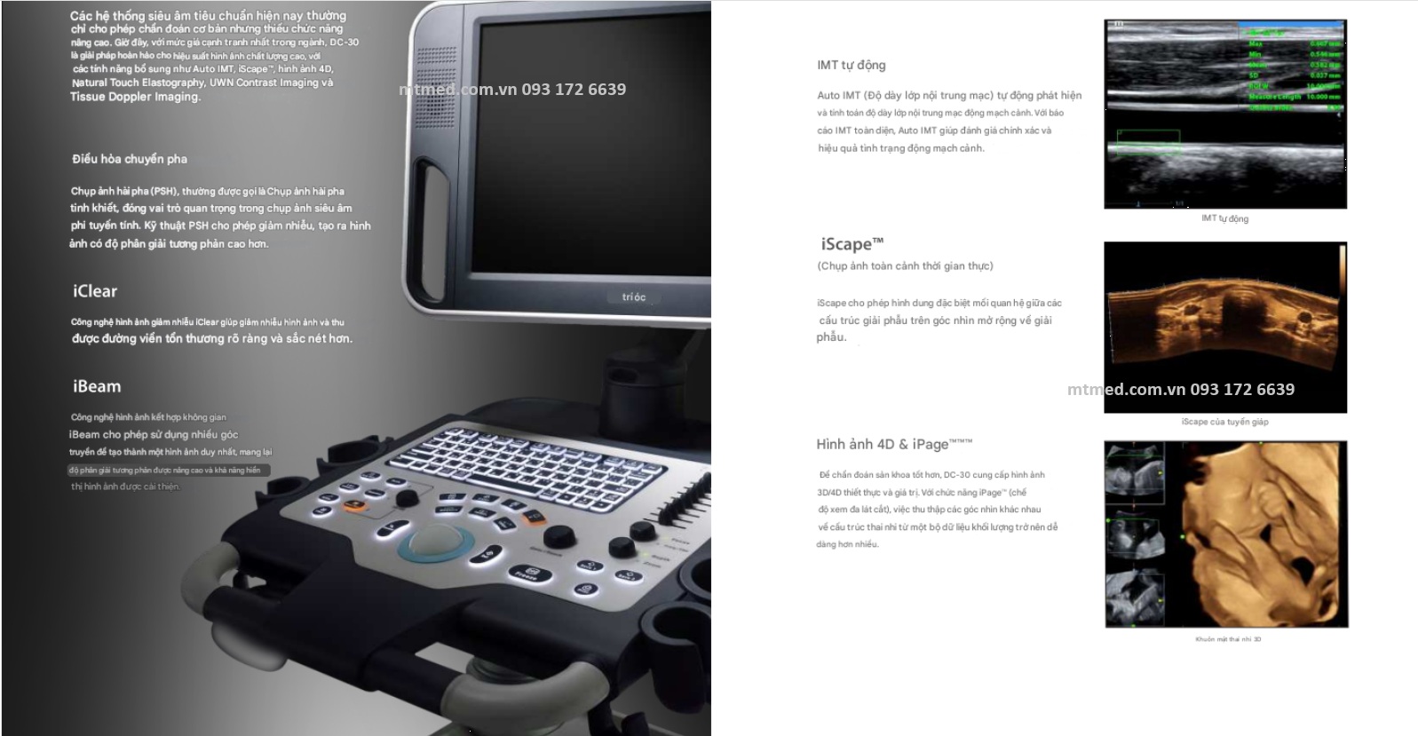 hình ảnh máy siêu âm dc-30 mindray