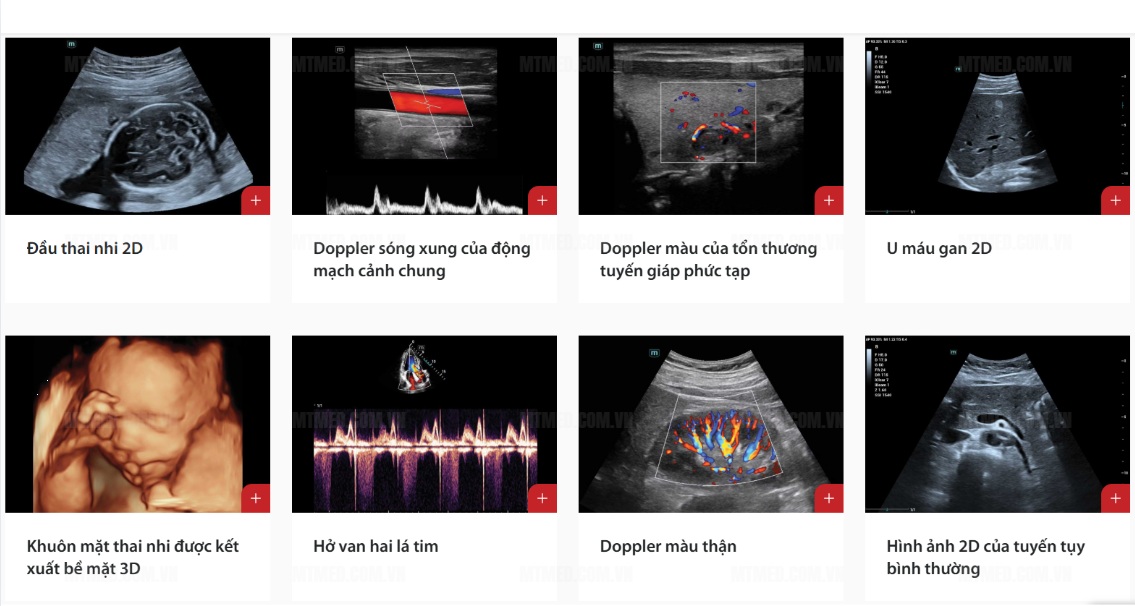 hình ảnh siêu âm của máy siêu âm màu n6