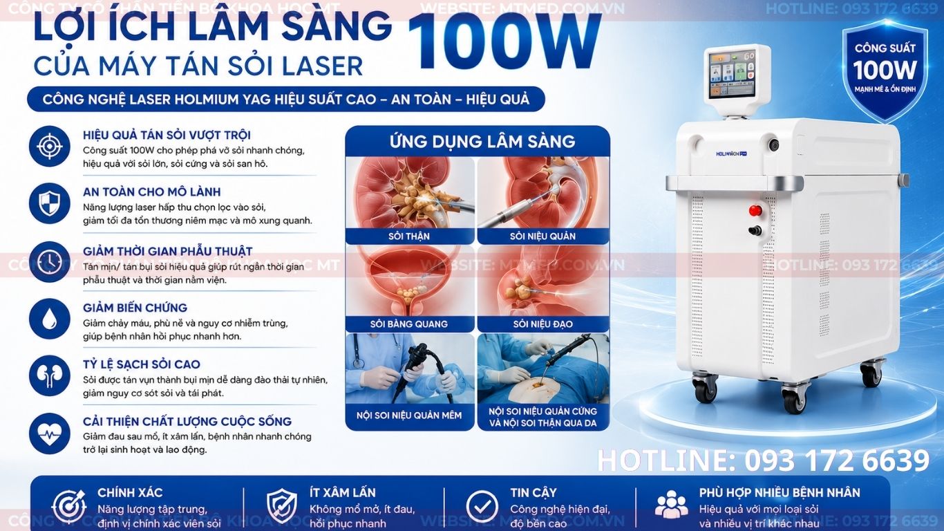 lợi ích lâm sàng của máy tán sỏi laser