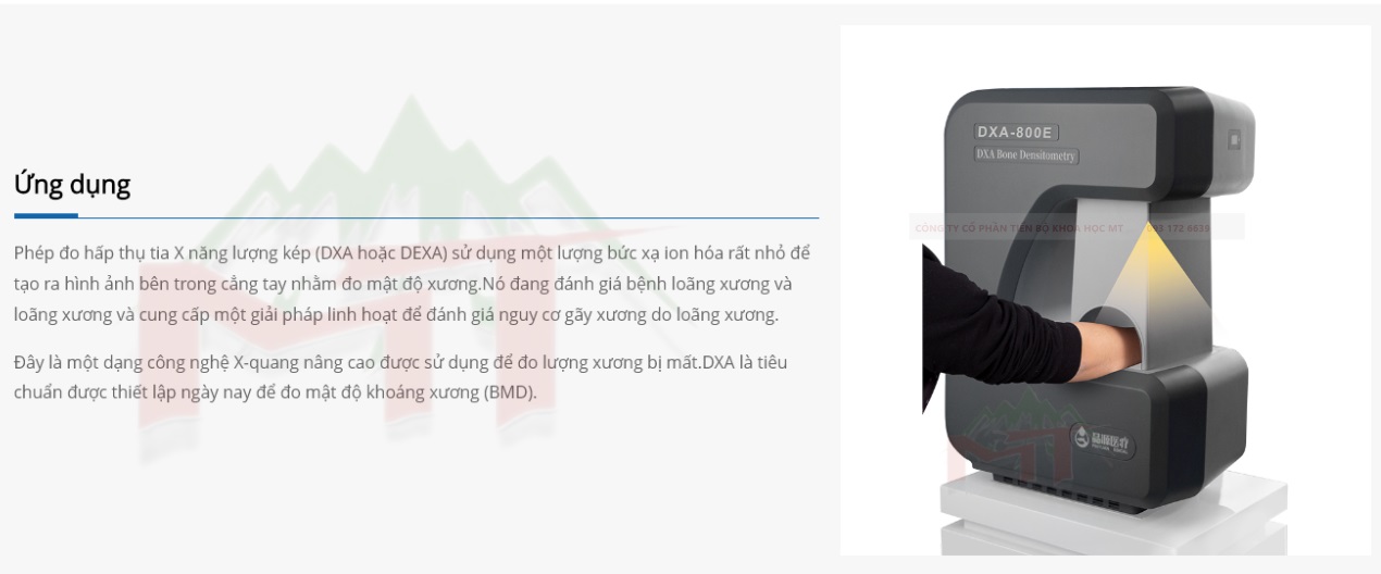 lợi ích của máy đo loãng xương dexa dxa 800e