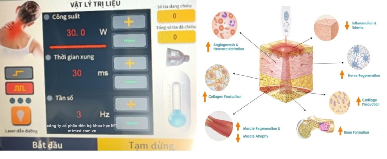 màn hình điều khiển máy laser trị liệu