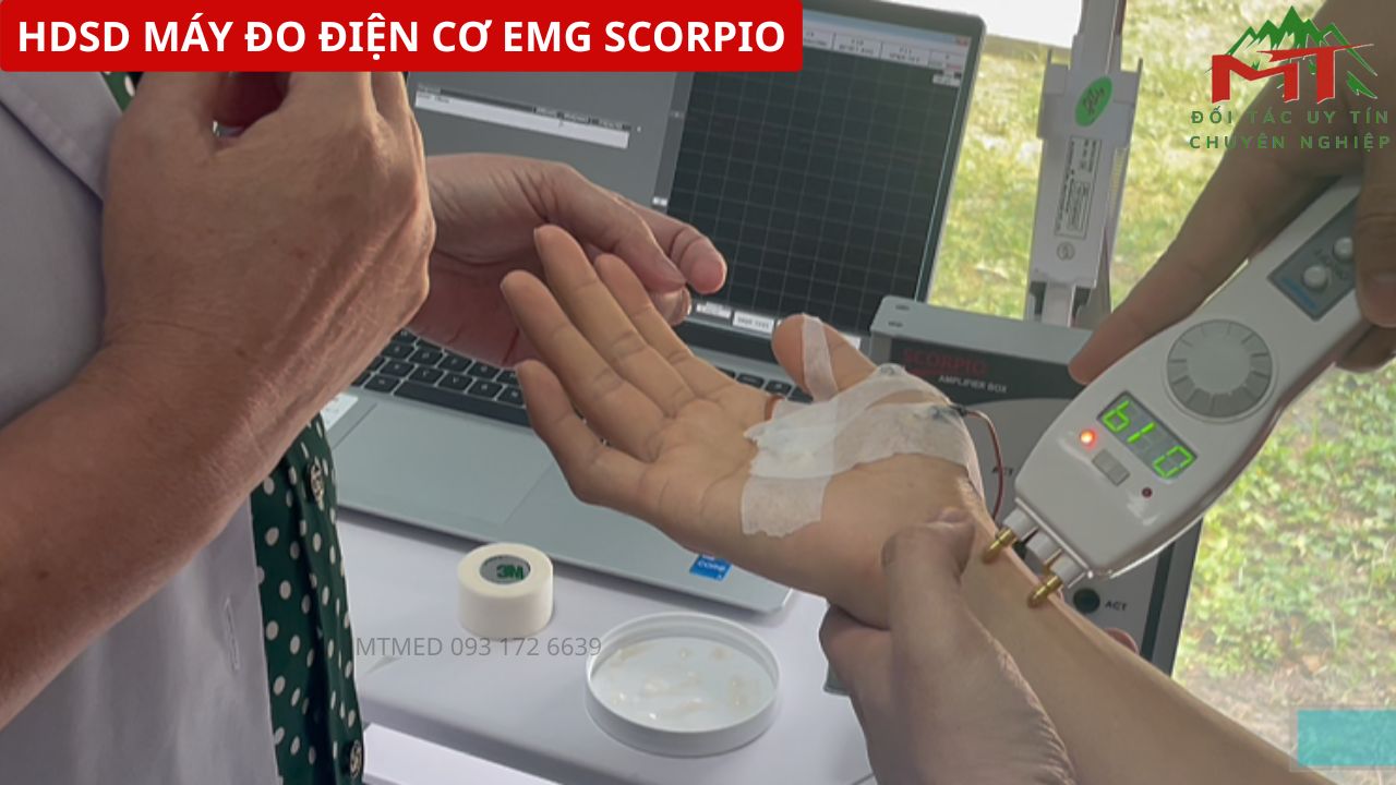 máy điện cơ đồ emg scorpio