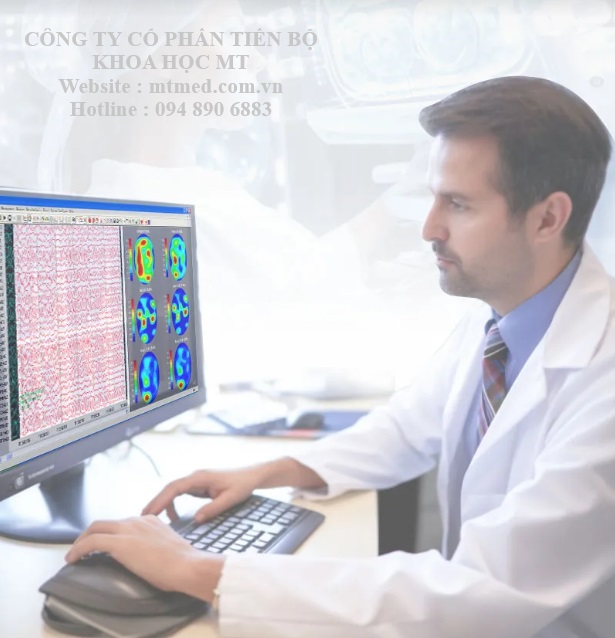 máy điện não kỹ thuật số giá tốt