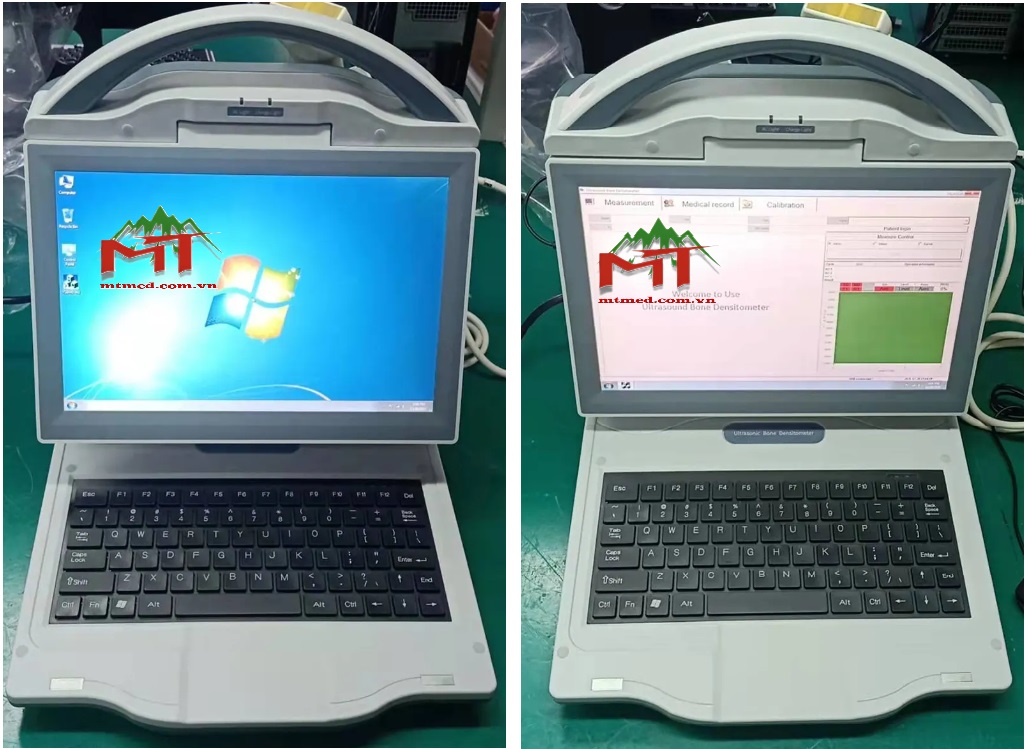 máy đo độ loãng xương-công ty cổ phần tiến bộ khoa học mt