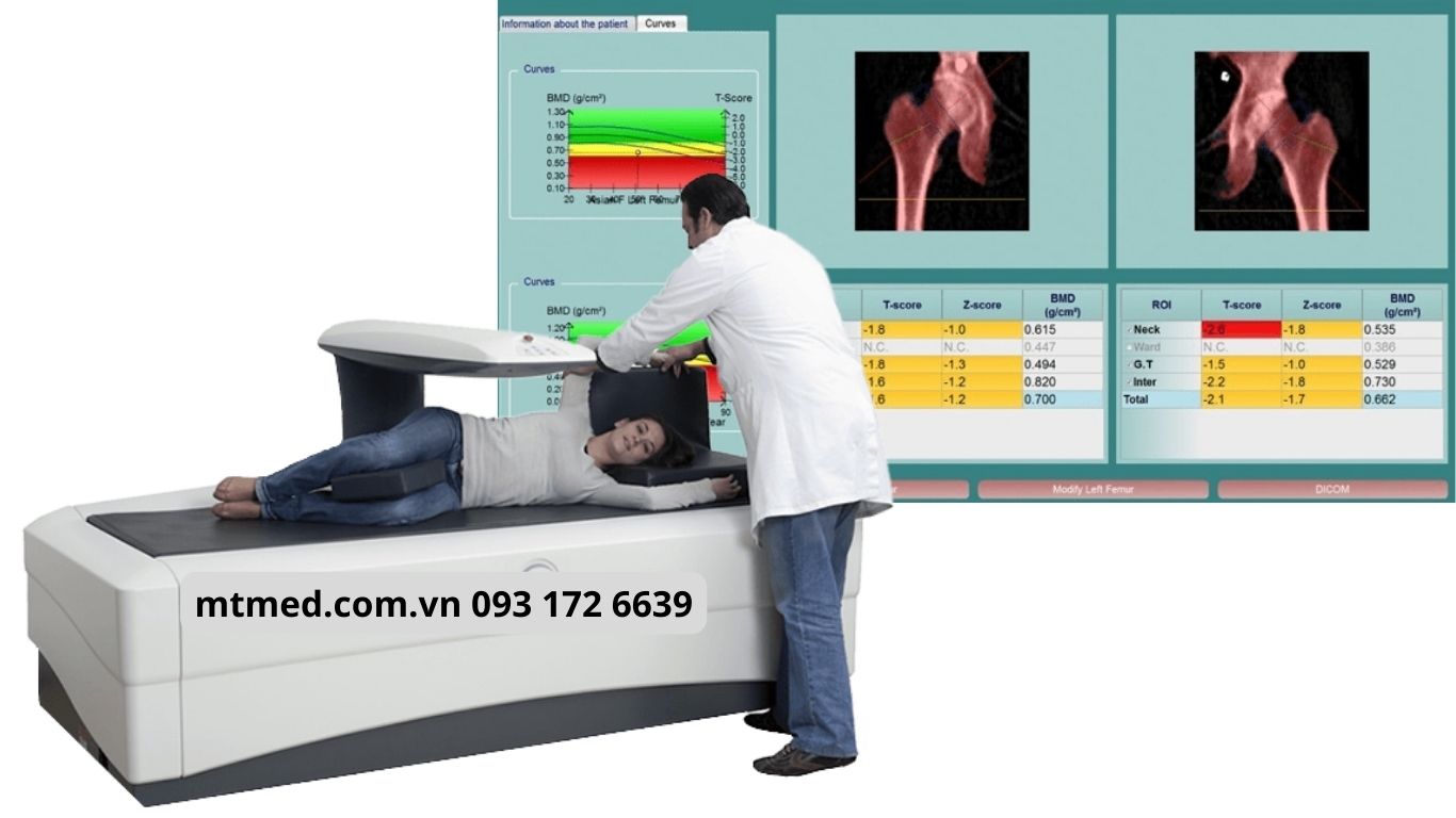 máy đo loãng xương xuất xứ châu âu