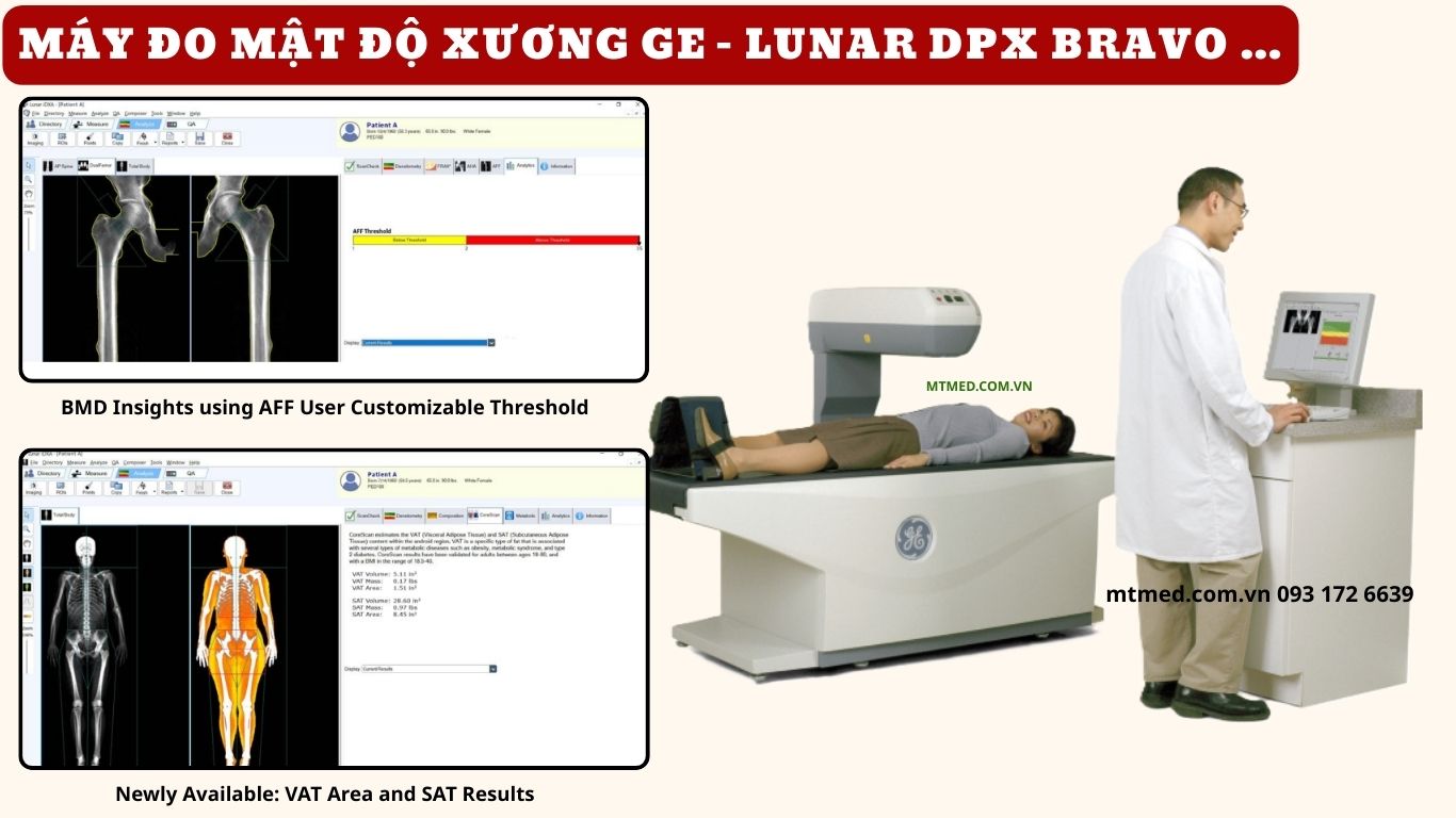 máy đo mật độ xương bravo GE