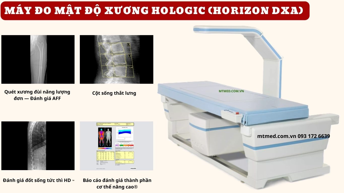 máy đo mật độ xương hologic