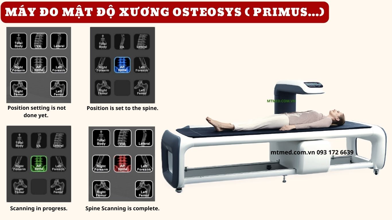 máy đo mật độ xương osteosys