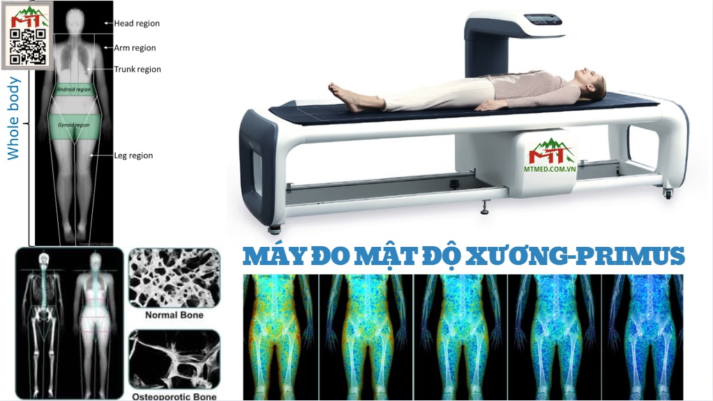 máy đo mật độ xương-primus