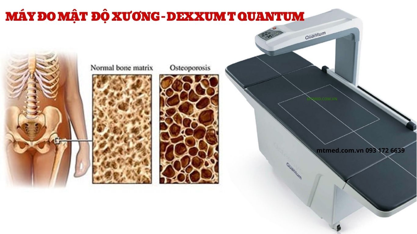 máy đo mật độ xương toàn thân dexxum-t-quantum