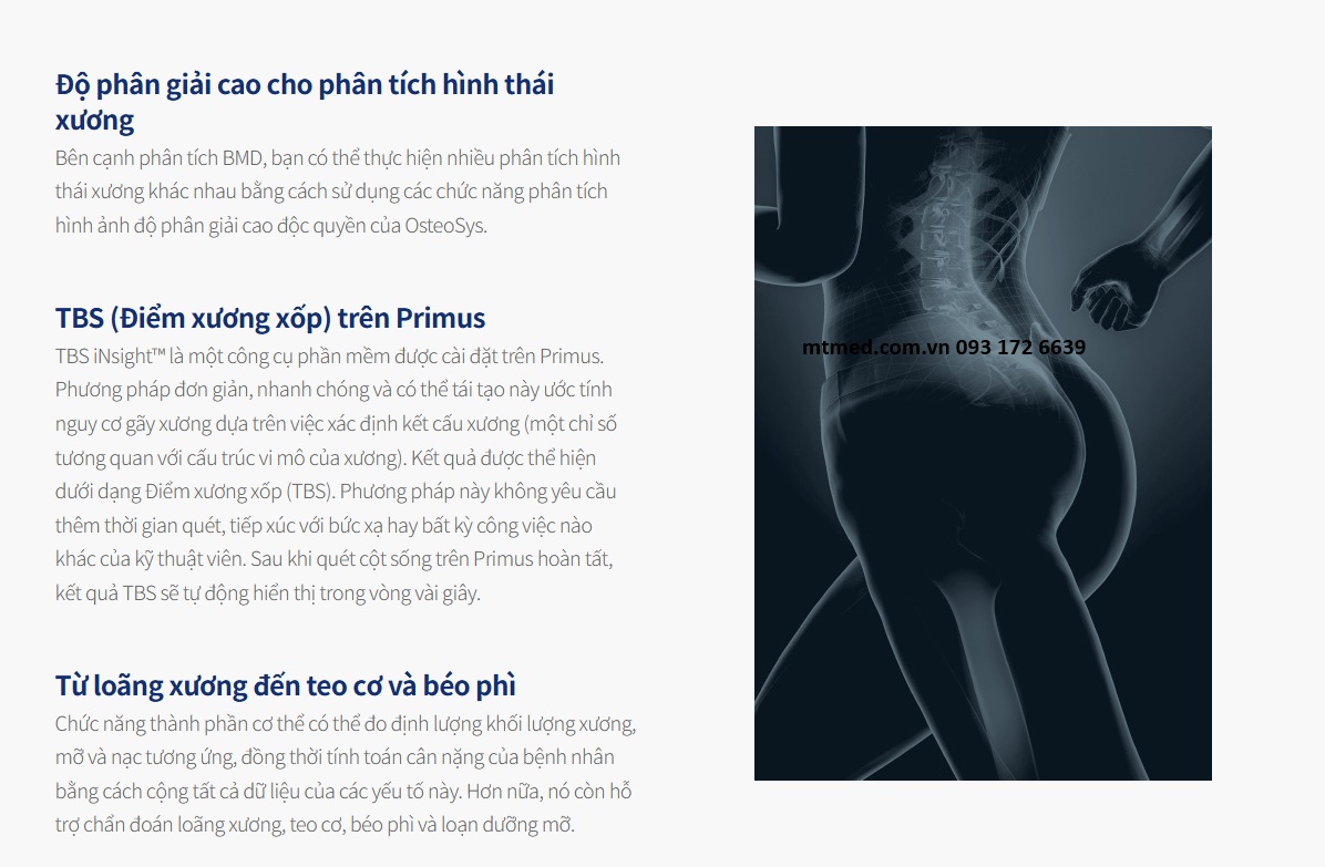 máy đo mật độ xương toàn thân-primus