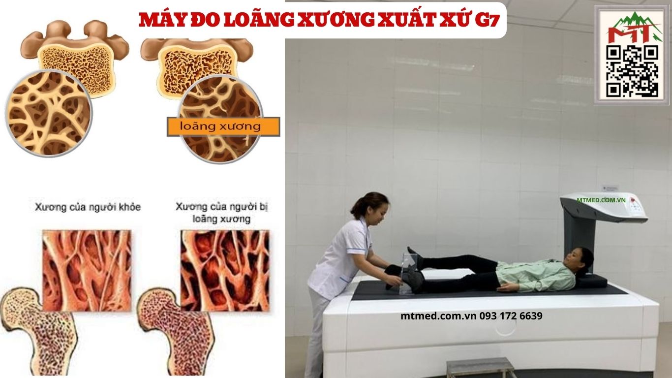 máy đo mật độ xương xuất xứ g7