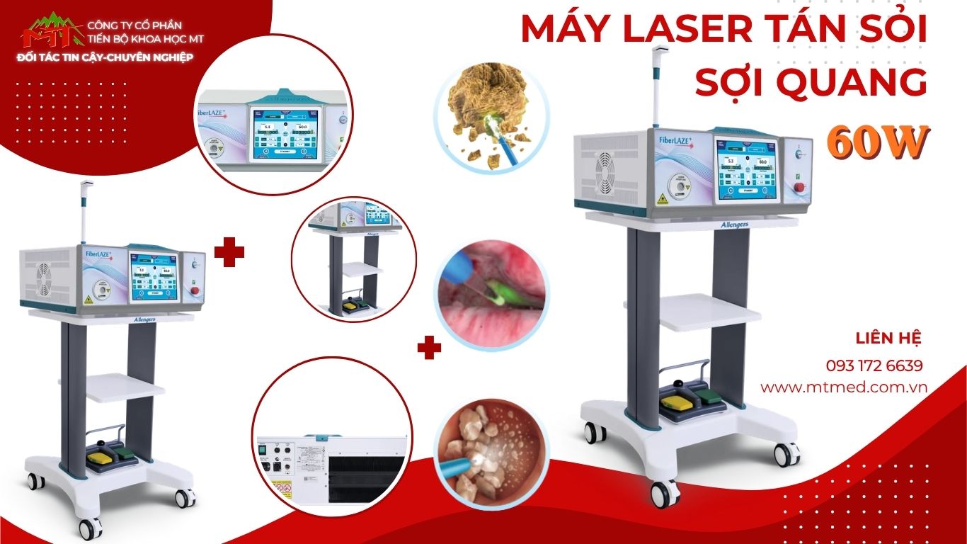 máy laser tán sỏi công suất 60w