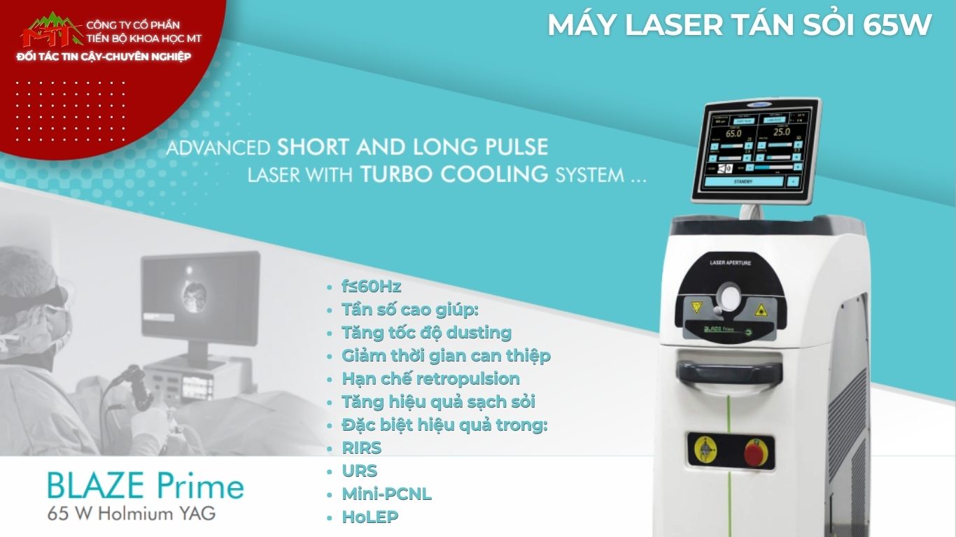 máy laser tán sỏi công suất 65w