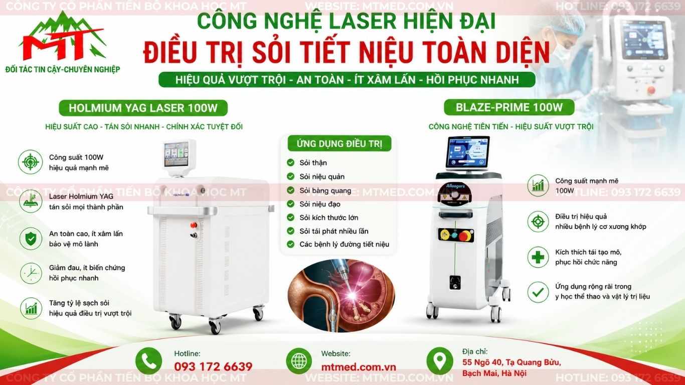 máy laser tán sỏi là gì