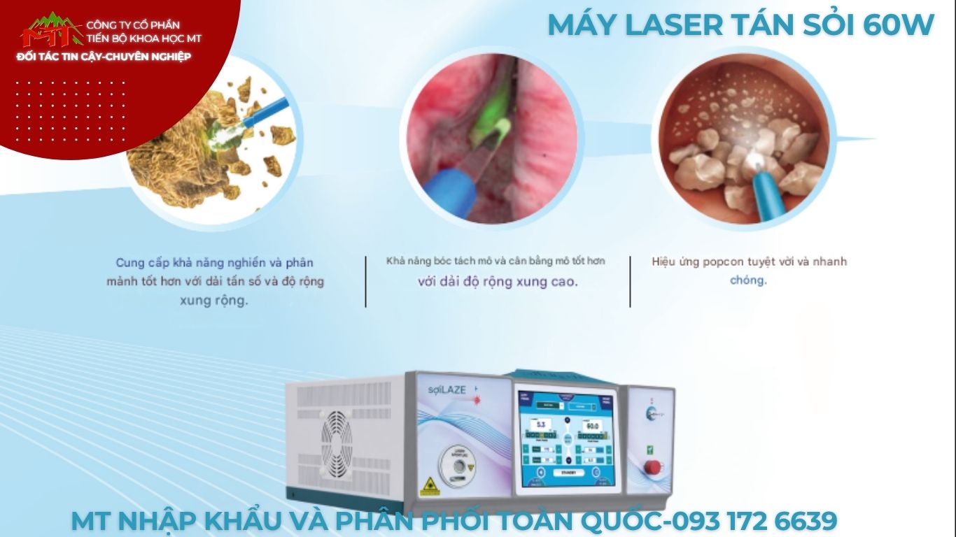 máy tán sỏi 60w