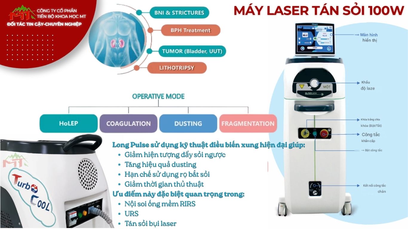 máy tán sỏi laser 100w