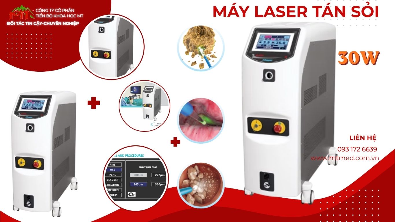 máy tán sỏi laser 30w