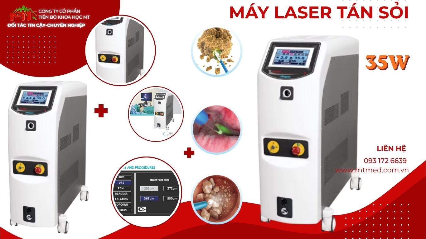 máy tán sỏi laser 35w