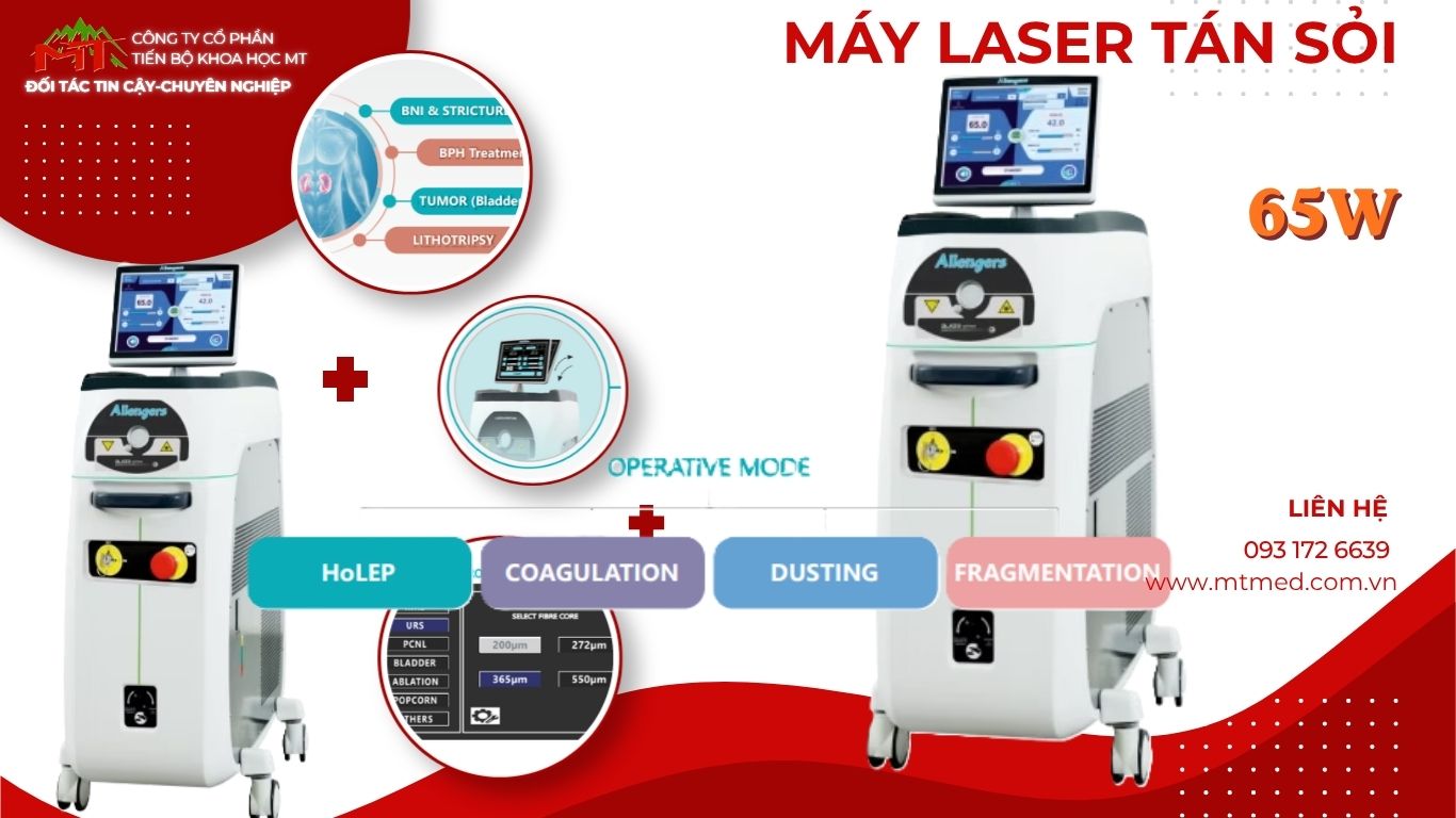máy tán sỏi laser 65w