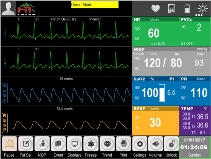monitor 5 thông số bt 770