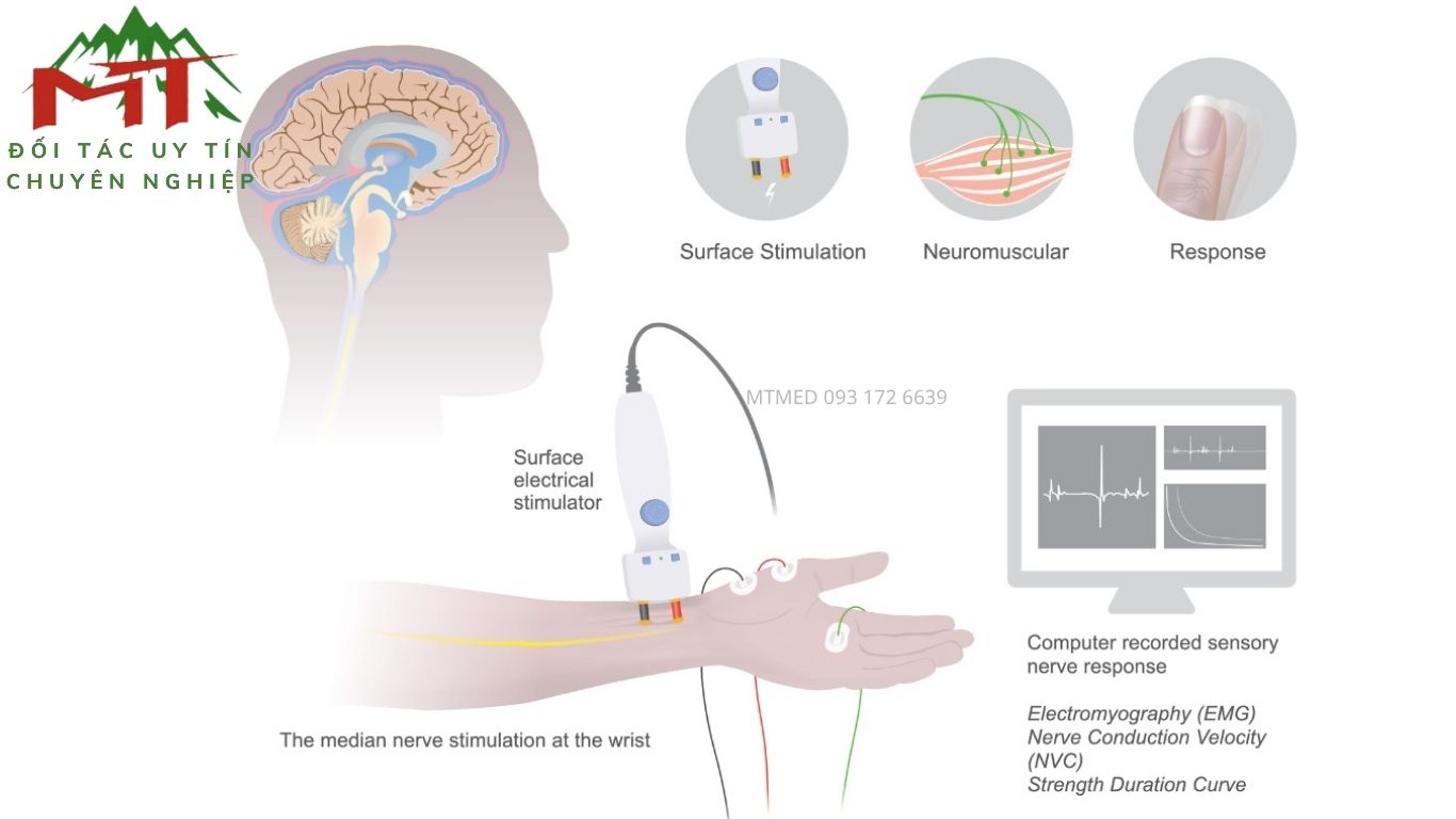 nguyên lý đo của máy đo điện cơ emg