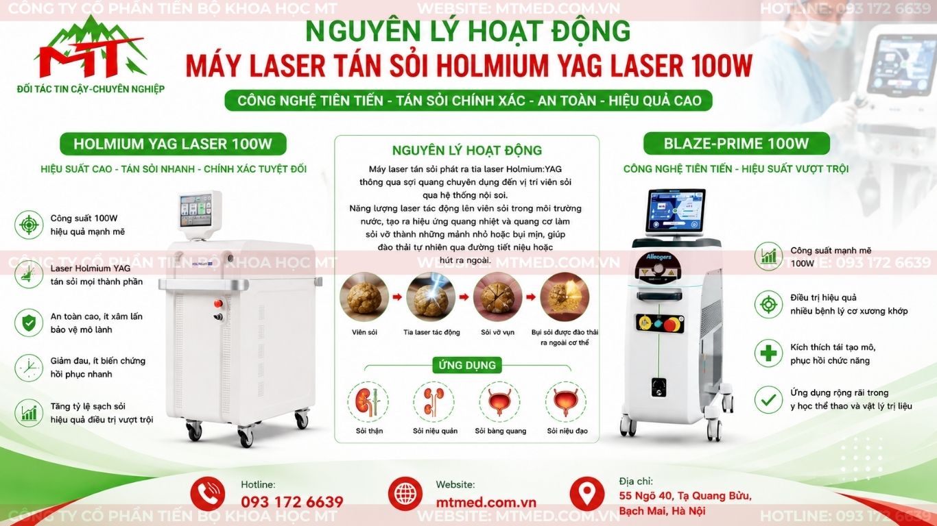 nguyên lý hoạt động của máy laser tán sỏi