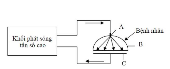 Nguyên lý hoạt động của dao mổ điện cao tần