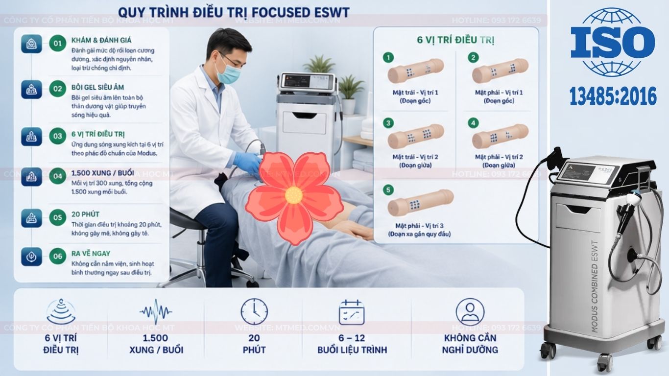 quy trình điều trị bệnh rối loạn cương dương bằng máy xung kích