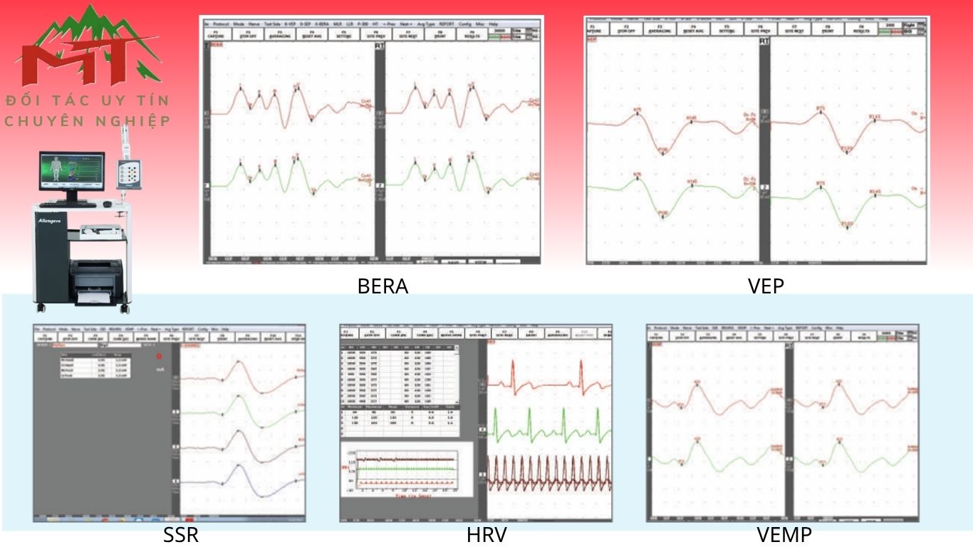 tác dụng của máy đo điện cơ đồ emg