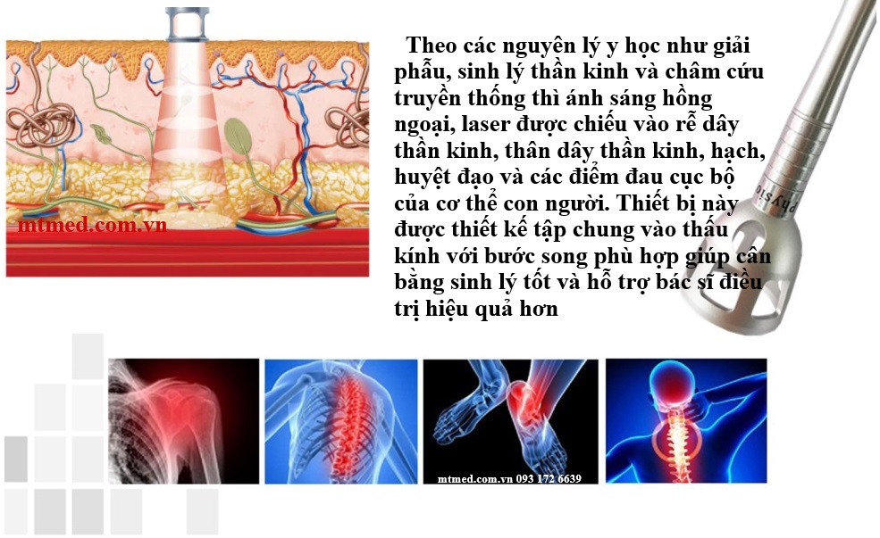 tính năng của máy laser trị liệu