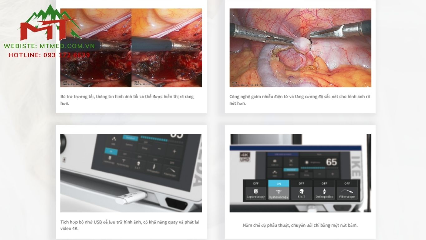 tính năng hệ thống phẫu thuật nội soi khớp 4k