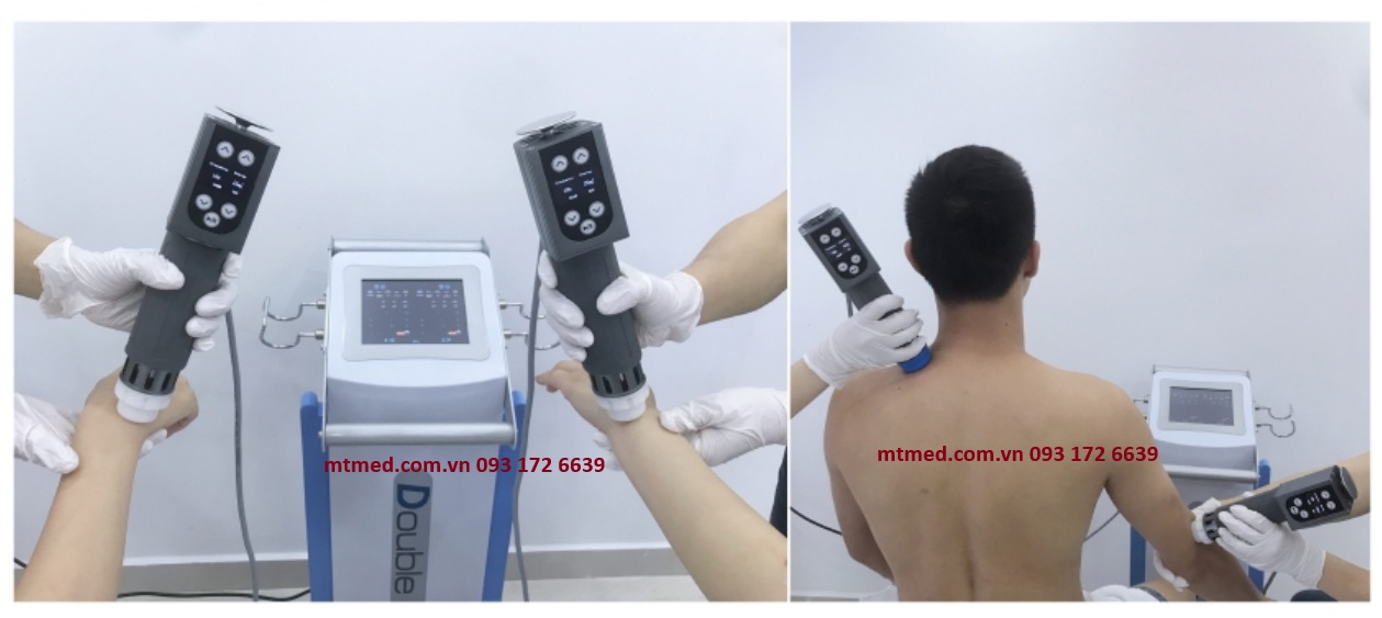 trị liệu bằng máy xung kích intelect