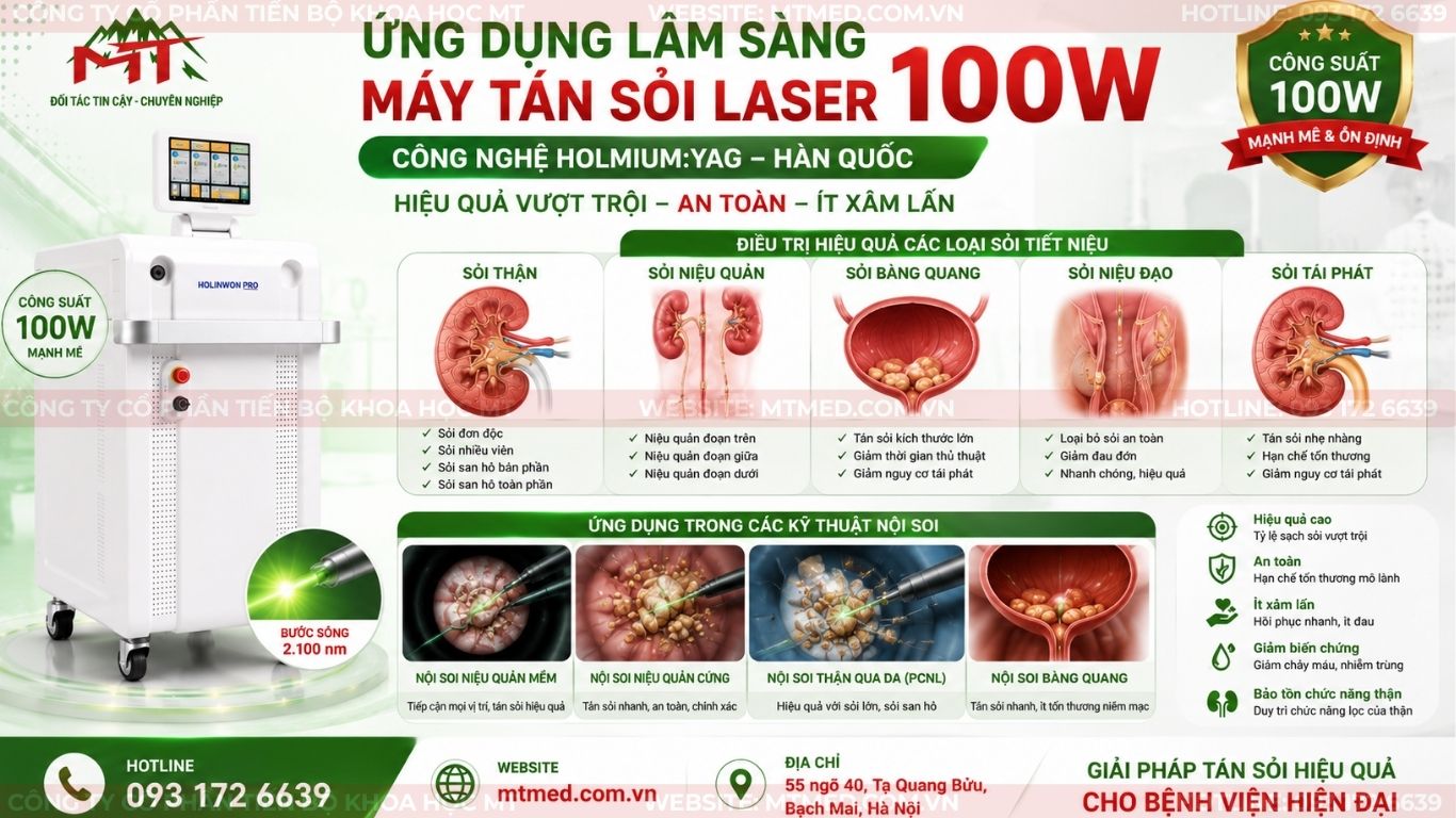 ứng dụng lâm sàng của máy tán sỏi laser 100w