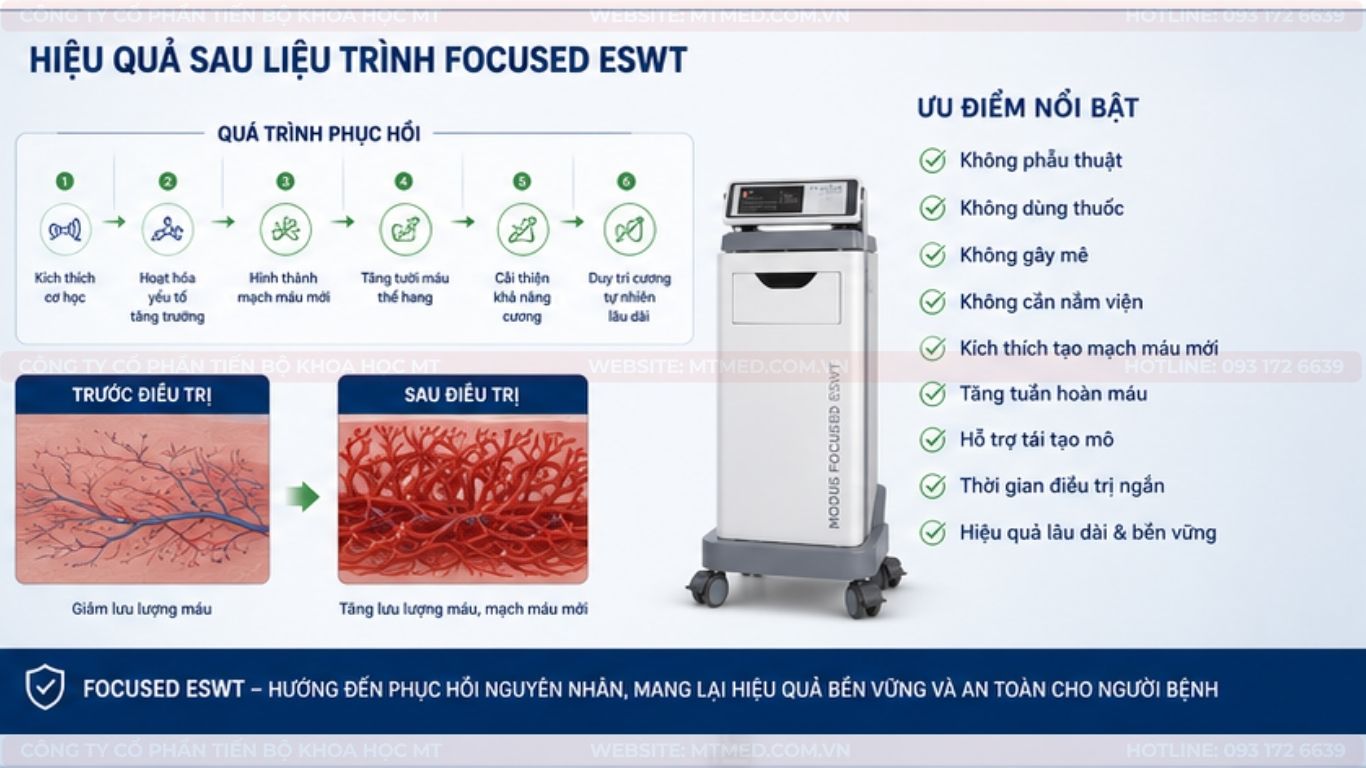 ưu điểm của máy xung kích điều trị rối loạn cương dương