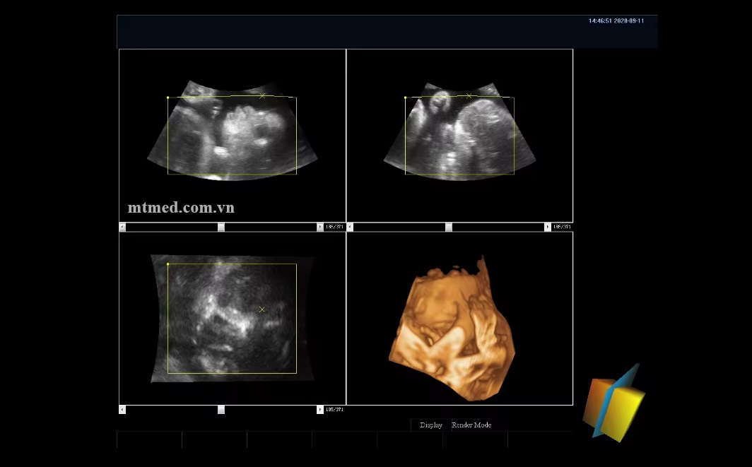 Máy siêu âm 4D cho động vật