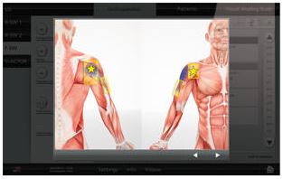 Máy điều trị sóng xung kích lan tỏa