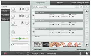 Máy điều trị sóng xung kích lan tỏa