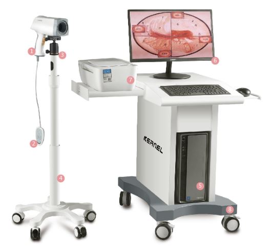 Máy soi cổ tử cung kernel